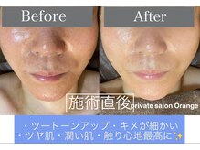 オレンジ(Orange)/プラズマ導入before after