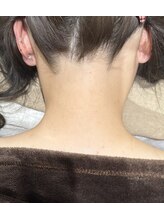 バブル(BUBRU)/うなじ脱毛