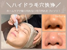 ルアイナ(Ruaina)の雰囲気（ハイドラ毛穴洗浄で毛穴の汚れをゴッソリ！つるつるの毛穴美人♪）