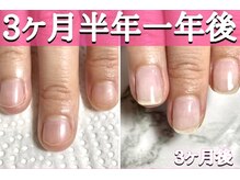 スターネイル(Starnail)/爪育ケア後綺麗にジェルでキープ