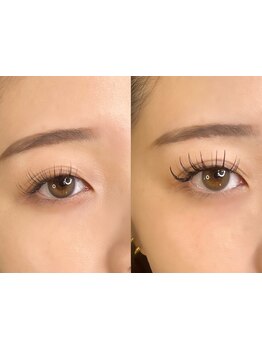 まつげのお悩み解決サロン