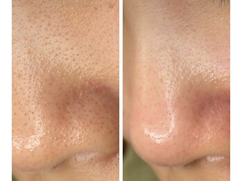 サイ(Sai)/before⇒after