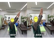 コウジュウドウプラス(耕揉堂Plus+)/施術前後の写真