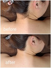 アースコアフュールボーテ ひたち野うしく店(EARTH coiffure beaute)/うなじ脱毛が人気♪