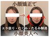 【エラ張り&むくみ解消】小顔矯正+最新超音波マシン60分★写真映えする小顔へ