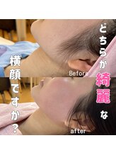 ケー(K)/フェイシャルワックス