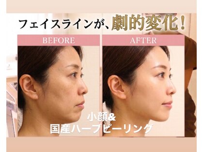 オーブ(Aube)の写真