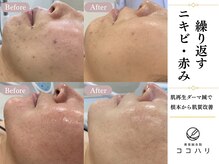ココハリ