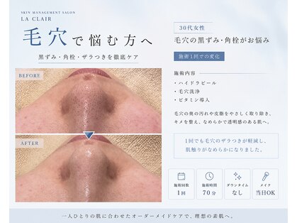 ラ クレール ビューティーサロン(LA CLAIR)の写真