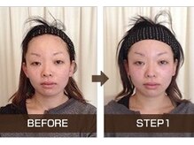 ライトワーク 西新宿店/小顔矯正