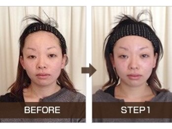 ライトワーク 西新宿店/小顔矯正