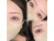ボニー(BONNY)の写真
