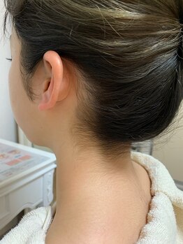 ヴィアンジュ 吉祥寺(Vieange)/襟足のシェービング（施術前）