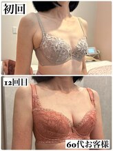 マイントゥー(mine too)/