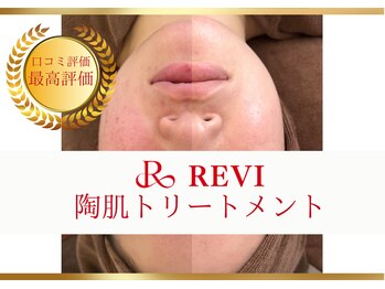 ルナージュ(LUNARJE)