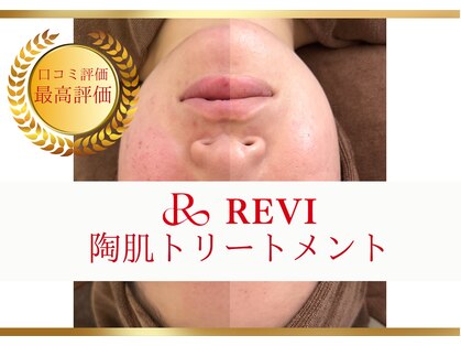 ルナージュ(LUNARJE)の写真