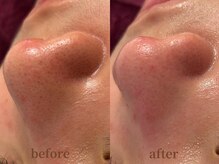 サロン エム(saron M)/お客様ビフォーアフター