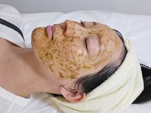 【剥離なし 肌質改善】ハーブピーリング