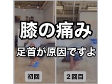 カワル整体 上通り院/階段の膝の痛みの原因