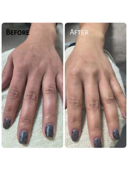 アイドット(i...)/手のケアにも♪ポテンツァエステ