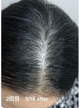 カブール 町田/2回で