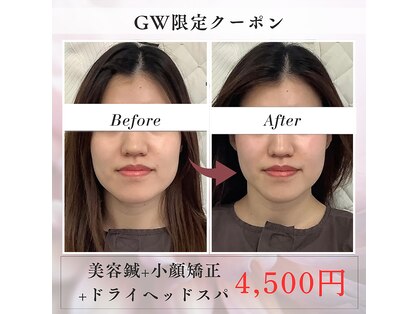 ハリサロンドオフ 堺東店(hari salon de off)の写真