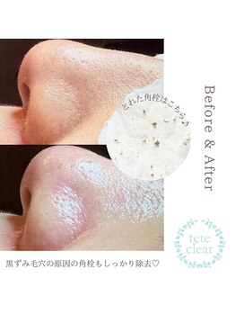 ソマリ(SOMALI)/20代 女性 Before & After