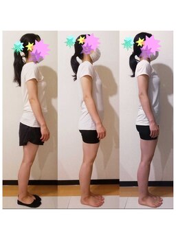 クーラクー(Coeur a Coeur)/反り腰巻き肩改善しませんか♪