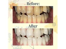スリール(sourire)の雰囲気（生まれ持った自然な白い歯に！）