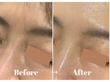 カラーリリー アンド ユン(Calla lily & yun)/ヒト幹細胞はコラーゲンを作る