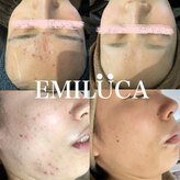 エミルカ 北谷店(EMILUCA)