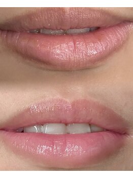 リリーブー 池袋(Lilyboo)/ローマピンク