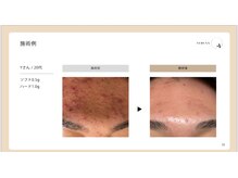 アロマビューティーサロン ジェイハウス(J)/