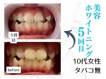 ルカノン(le canon)/友だちに褒められました(^^)　