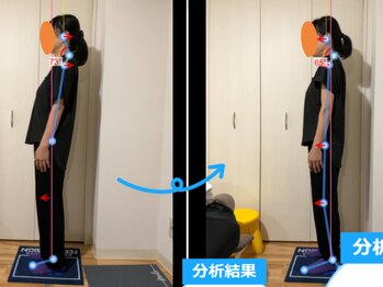 みふく整体院/施術前と施術後の姿勢チェック
