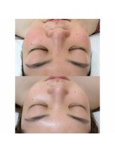 サロンエヌ(salon N)/フェイスWAXとまつ毛パーマ