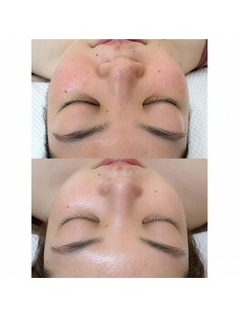 サロンエヌ(salon N)/フェイスWAXとまつ毛パーマ