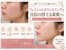 ◆◇◆肌トラブルゼロ　美肌・小顔・肌育　無料カウンセリング◆◇◆　