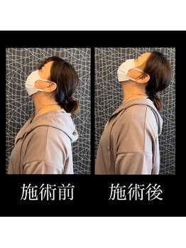 カラダラボ(Karada LAB)/Before After