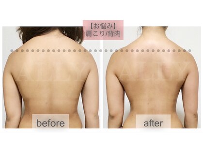 アリー(ALLY)の写真