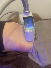 ルアナ(Luana)/チラシでの脂肪冷却のご来店♪