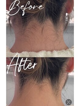 ピリナ(Pilina)/襟足シェービング