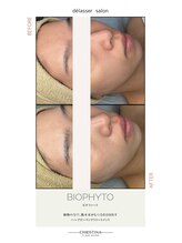 デラッセ(Delasser salon)/デトックスハーブ◎ビオフィート