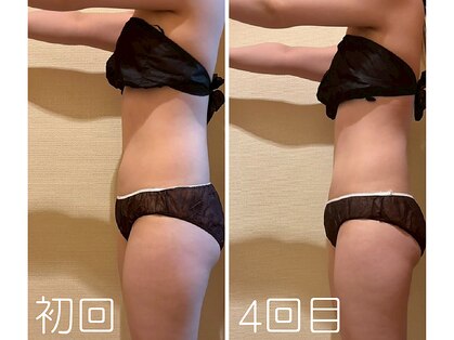 ヨサパーク スリアン(YOSA PARK Souriant)の写真