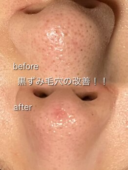 リイル バイ クレビア(REILE by Crebia)/お客様写真