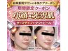 【結果重視即効性◎】サーマナイフ＆ダクトピール　小顔＆美肌最強メニュー