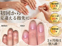 マニブルーム