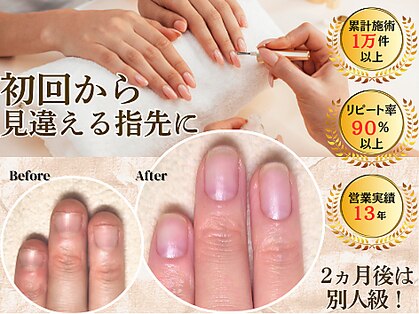 マニブルームの写真