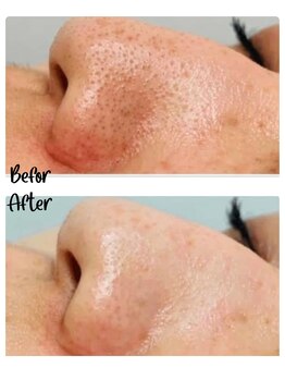 リジューブ(Rejuve)/目指せ!毛穴レス肌!