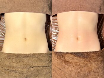 ルーナジェーナ(Luna llena)/池袋 エステ ルーナジェーナ